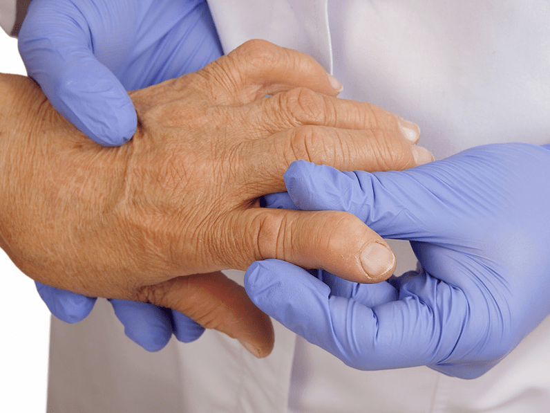 lekarz bada dłoń pod kątem bólu stawów palców